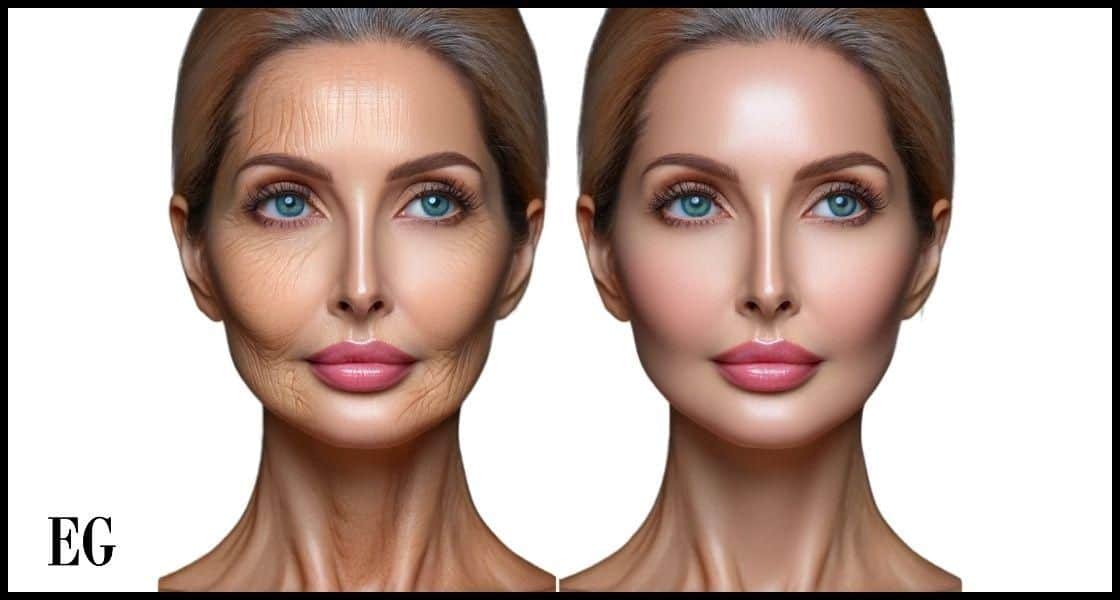 Mujer mostrando un antes y después de un tratamiento de radiofrecuencia facial.
