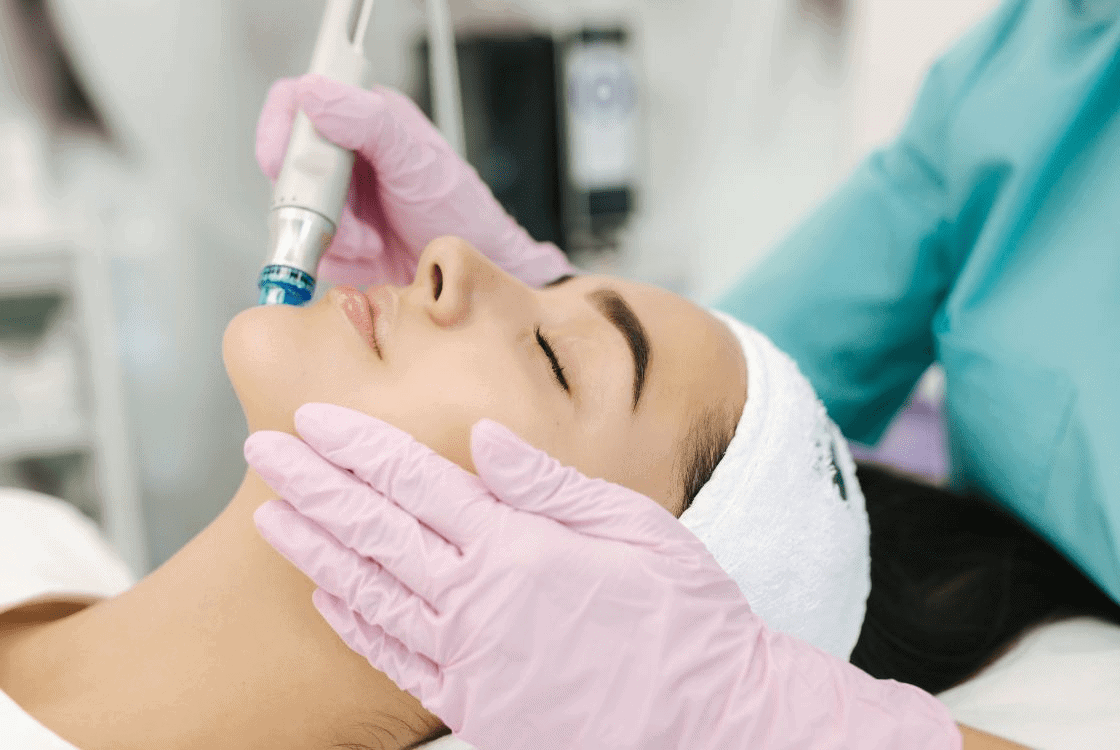 ¿Cómo La Microdermoabrasión Puede Transformar Tu Piel en Pocas Sesiones?